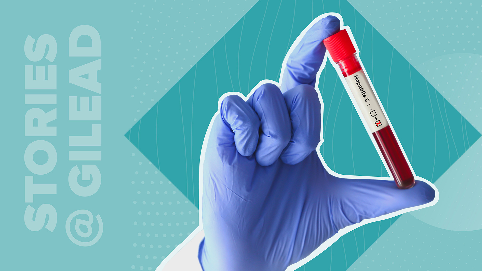 Graphics photo of Hep C vial.